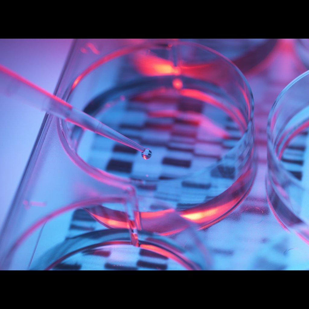 Amplirun® Streptococcus Agalactiae DNA Control size: 10,000size:20,000 c/µL