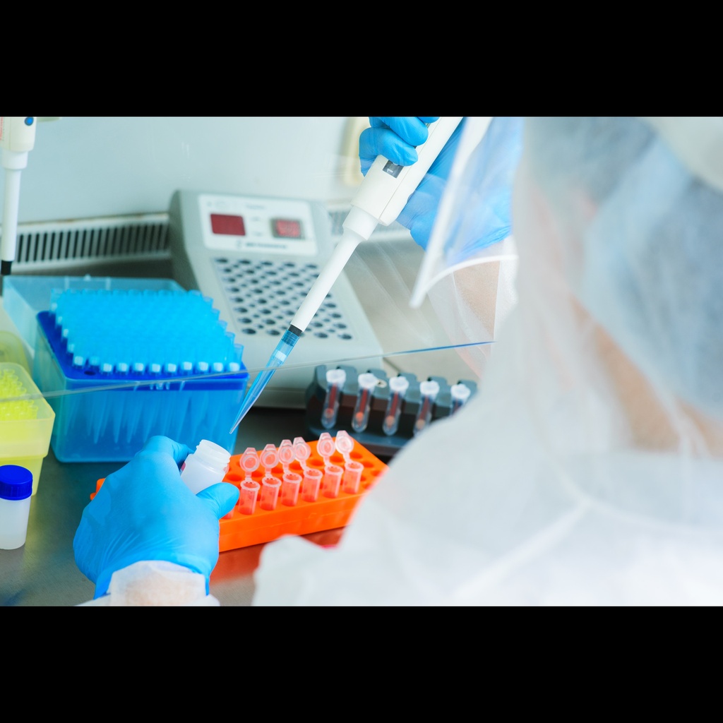 ChamQ SYBR Color qPCR Master Mix  Without ROX  size: 500 Reactions  20 µL/Reaction 
