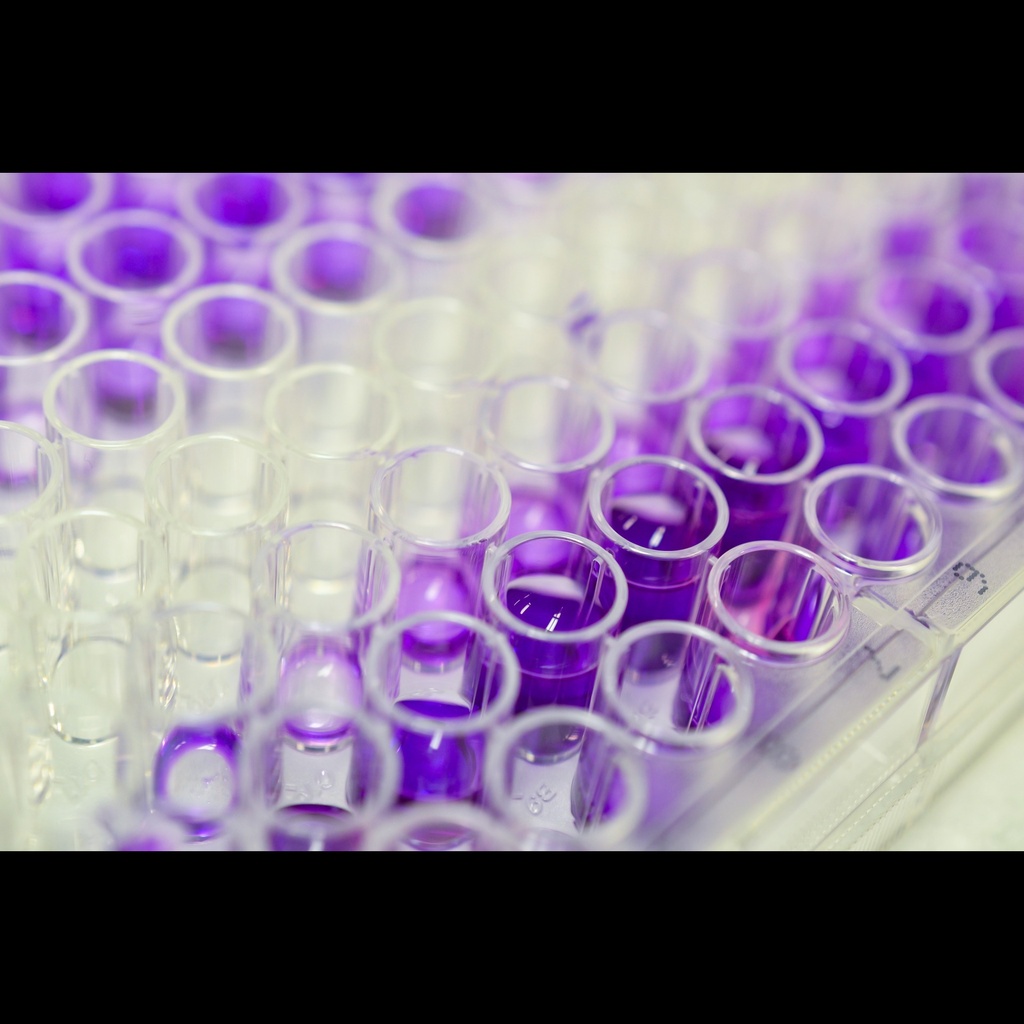 Corticosterone  Human, Rat, Mouse  ELISA